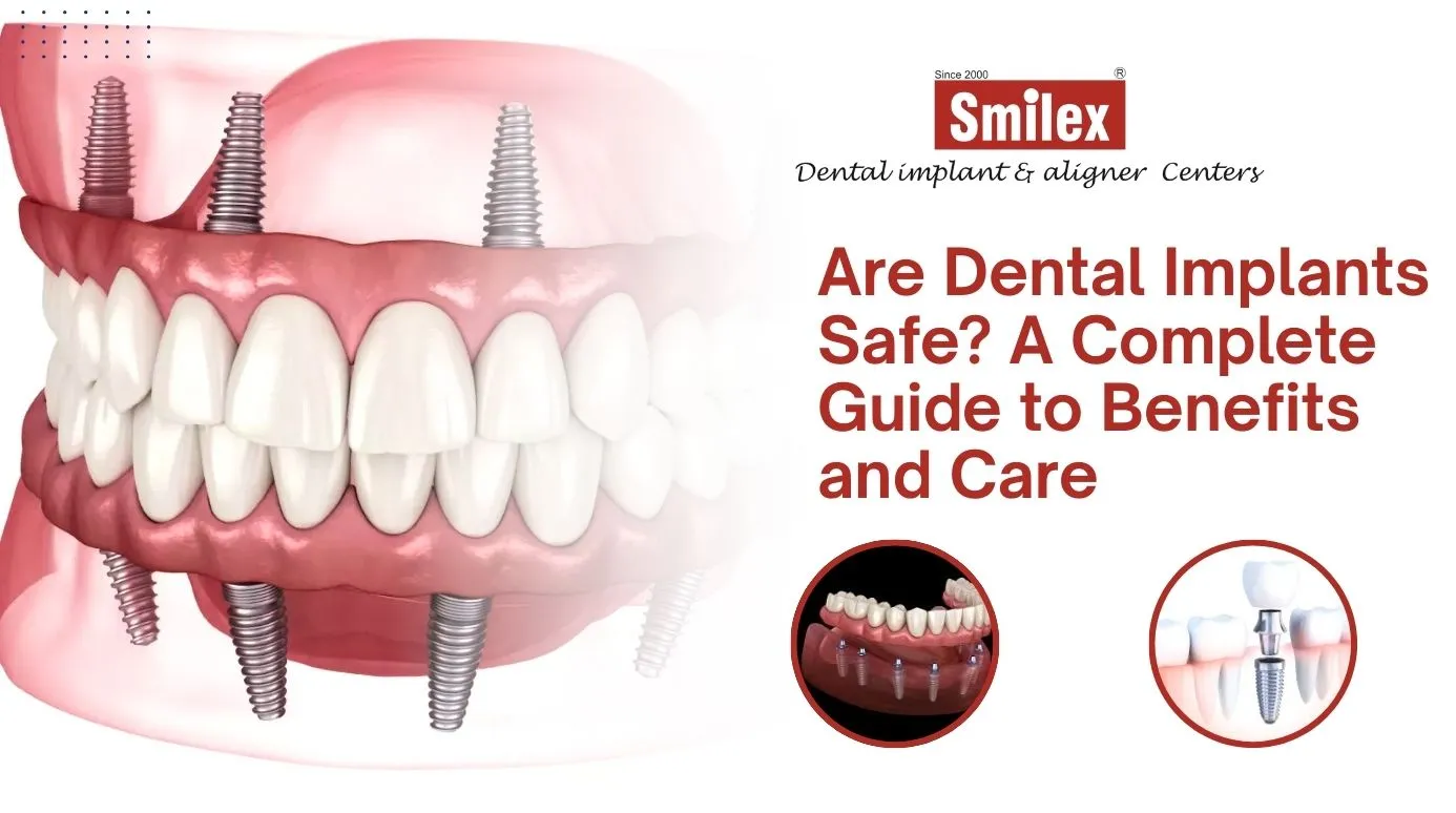 Dental Implants