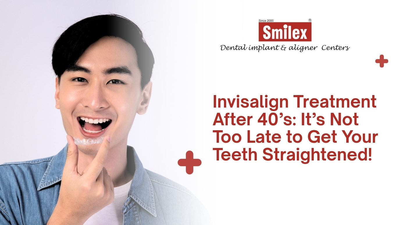 Invisalign Treatment After 40’s