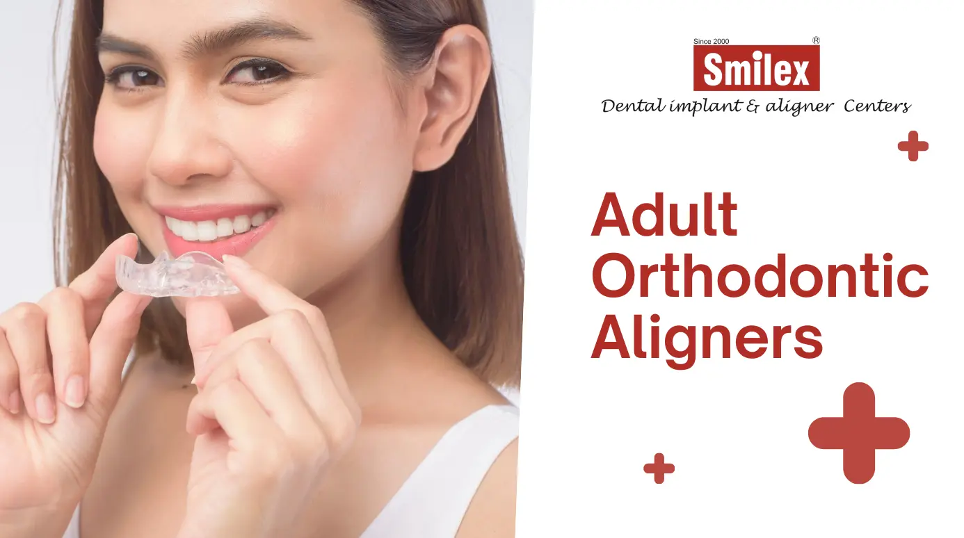 Orthodontic Aligners