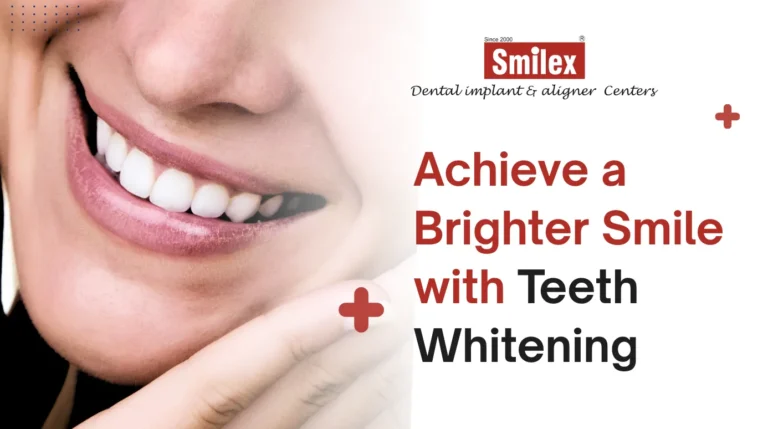 Teeth Whitening