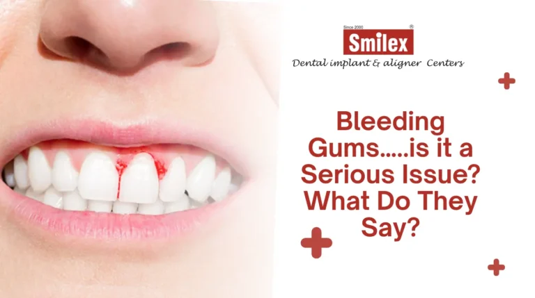 Bleeding Gums