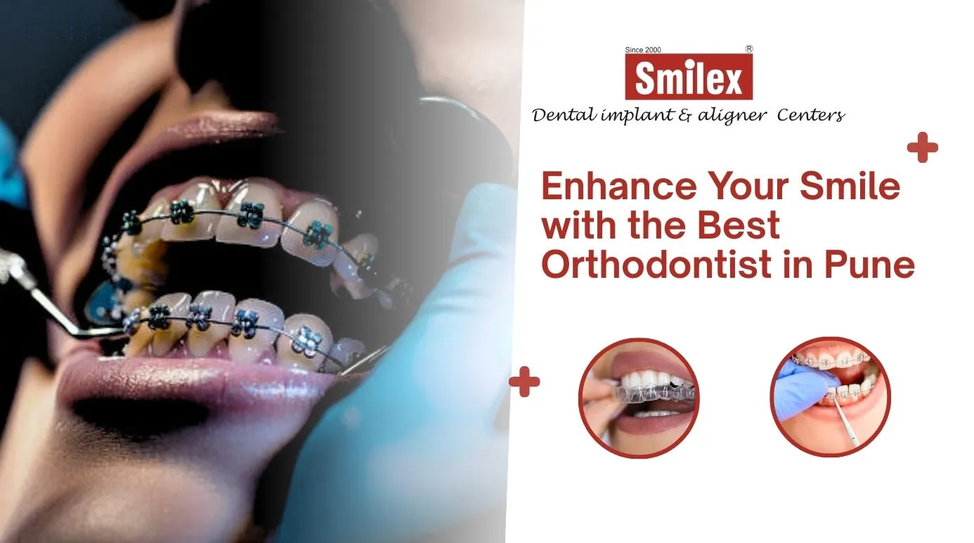 Orthodontist in Pune