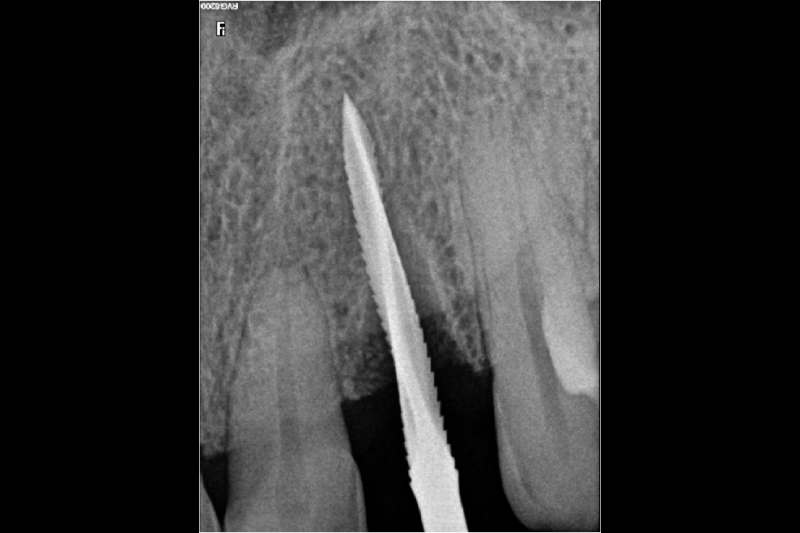 Get a same day smile today.
