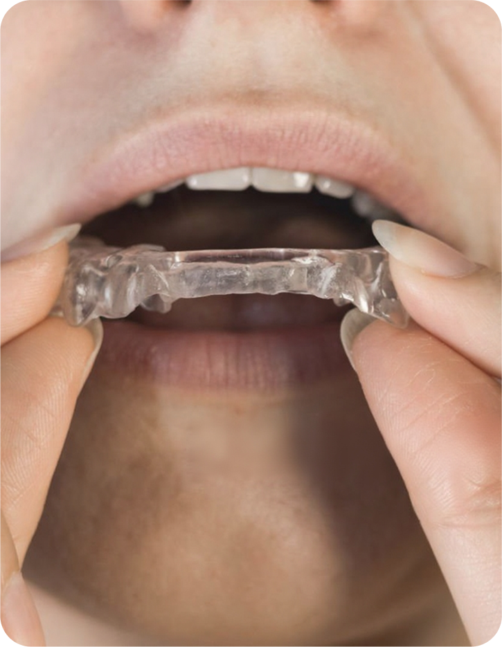 Bite Correction and TMJ Care