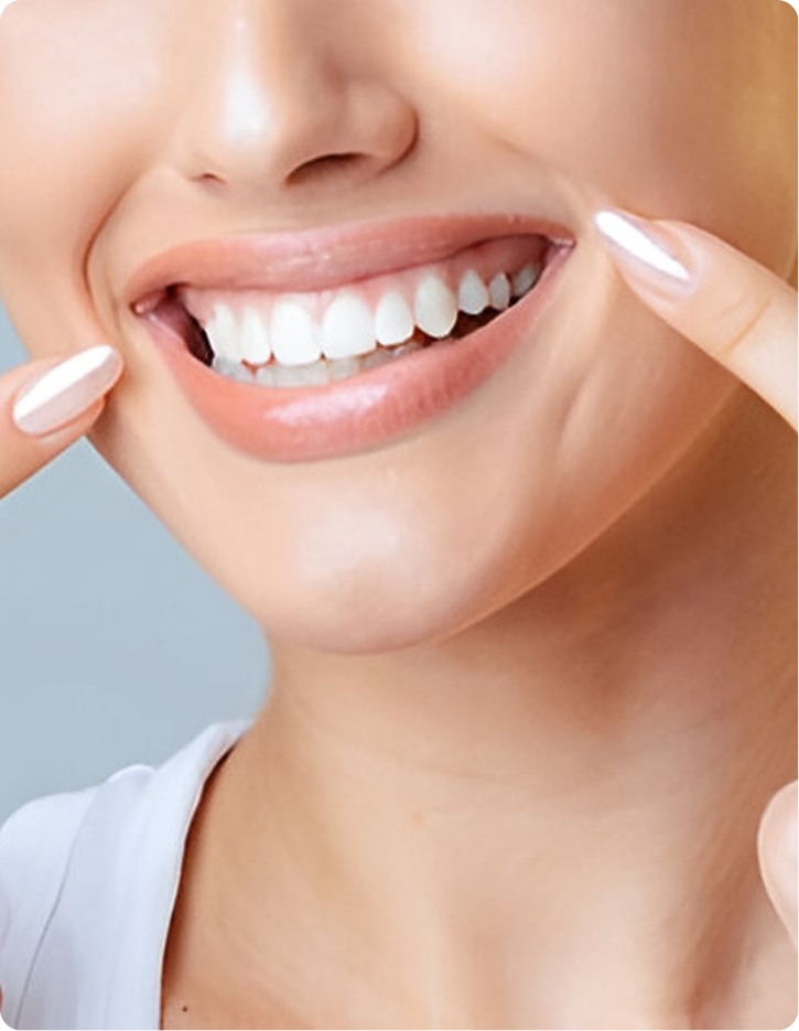 Teeth Whitening