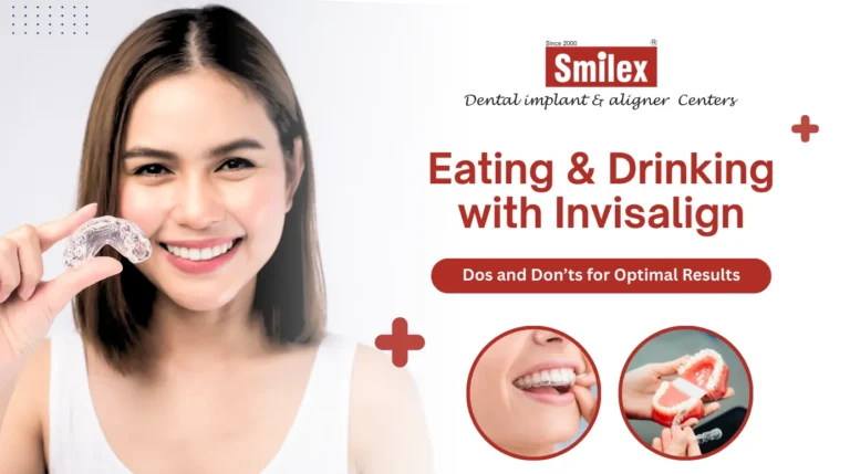 Invisalign
