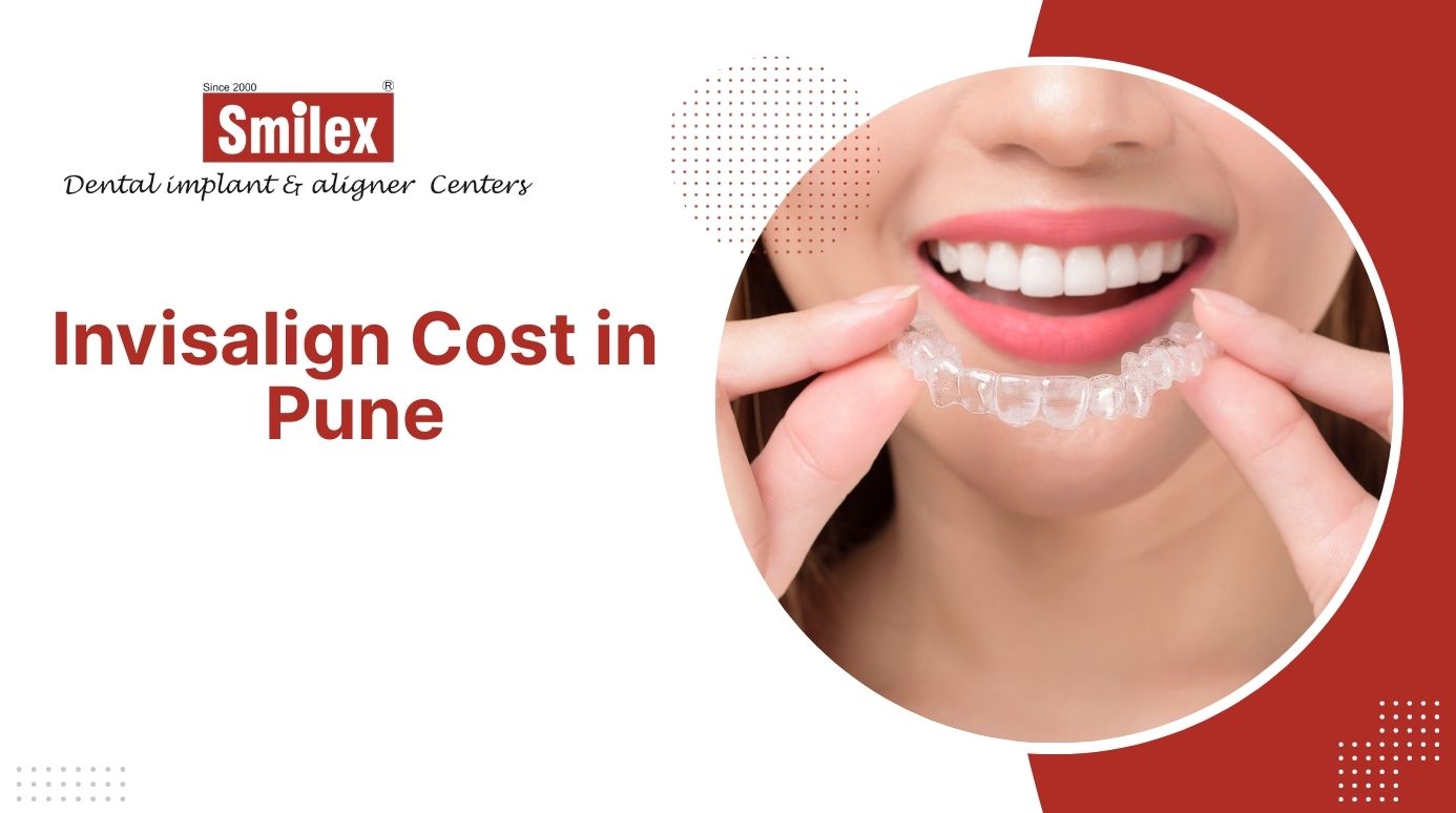 Invisalign Cost in Pune