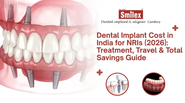 Dental Implant Cost in India