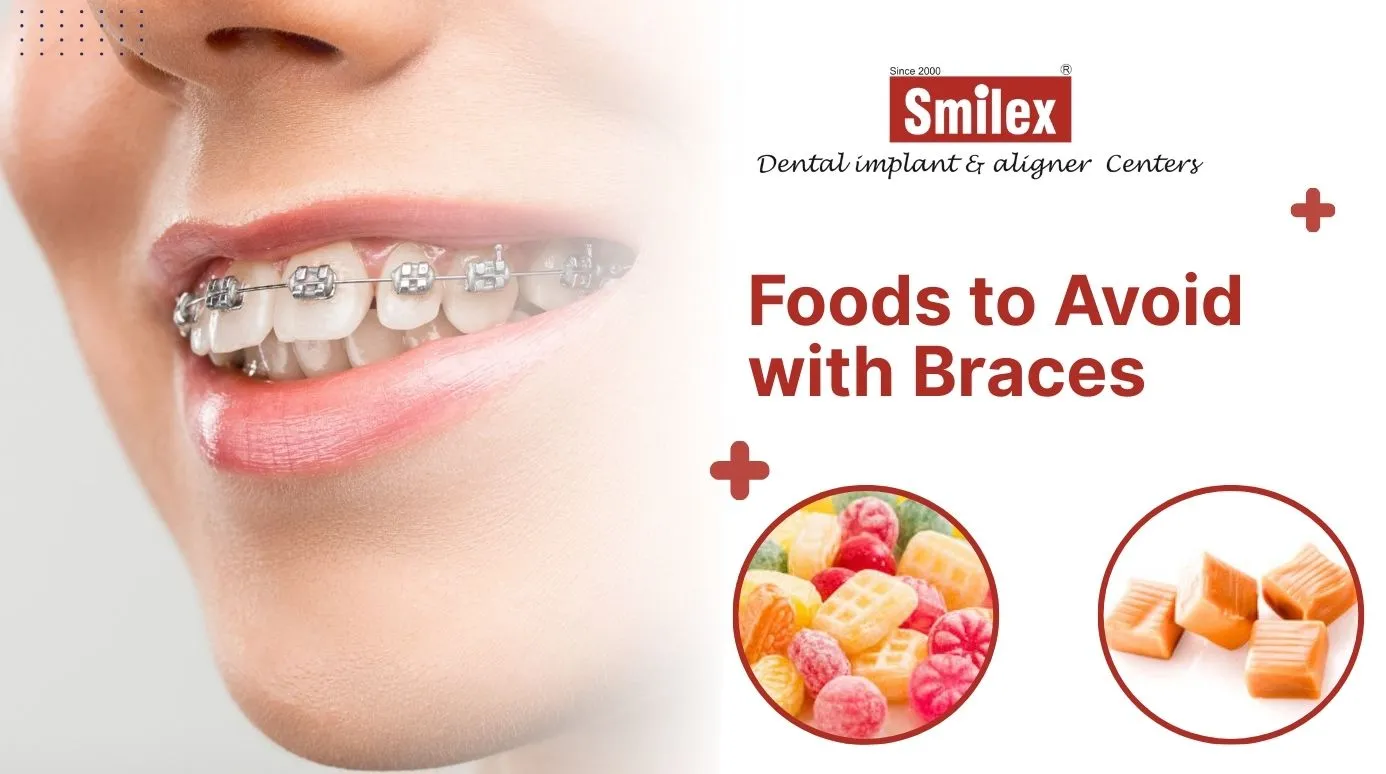 Foods to Avoid with Braces: Expert Advice from an Orthodontist in Pune